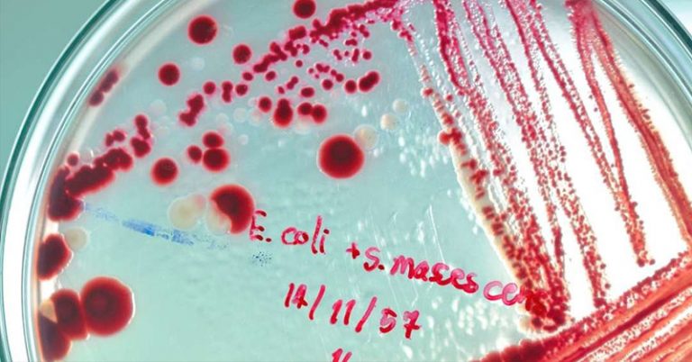 Artificial Intelligence Finds A Powerful New Antibiotic For The First Time - Featured image