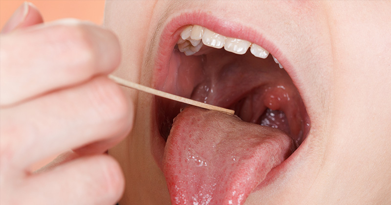 Have You Had Your Tonsils Removed? We May Have Some Bad News For You.