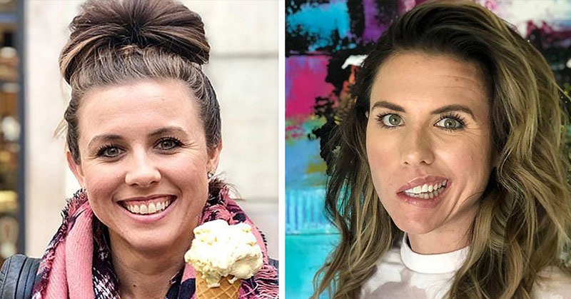 Nutritionist Woke Up With Half Her Face Paralyzed Caused By Stress