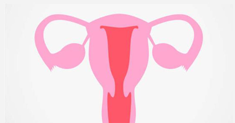 Polycystic Ovary Syndrome: Does Sugar Consumption Affect PCOS?