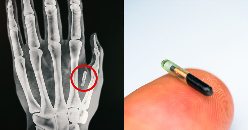 Michigan is trying to make it illegal for companies to put microchips in their employees