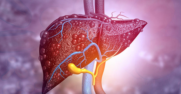 High-fructose and high-fat diet damages liver mitochondria, study finds - Featured image