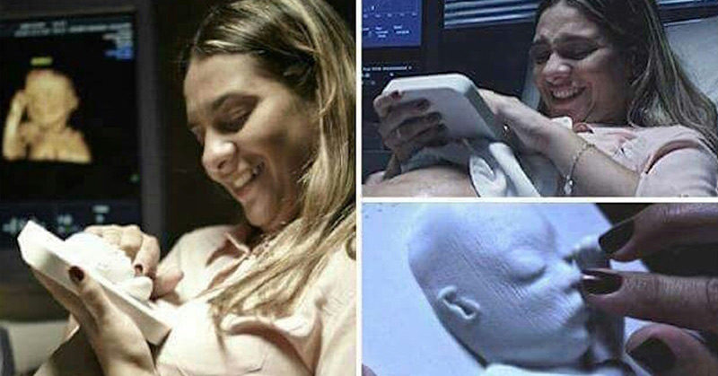 Doctors Made A 3D Print Of An Ultrasound For A Blind Expecting Mama