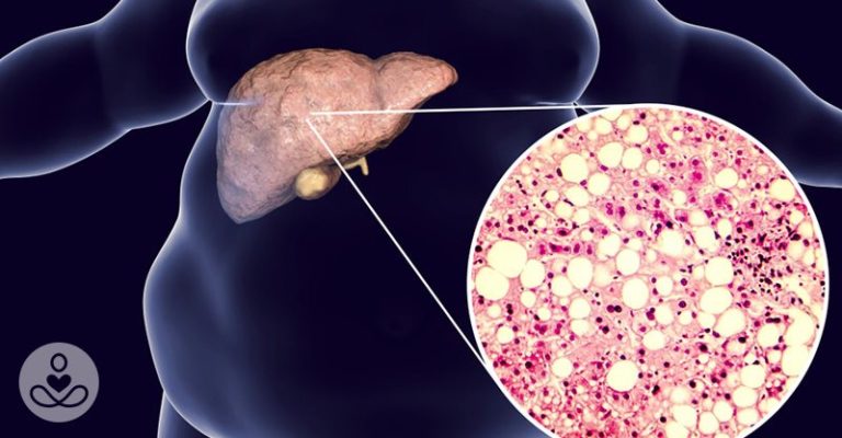 How Excess Sugar Can Impact Your Brain, Liver and Kidneys - Featured image