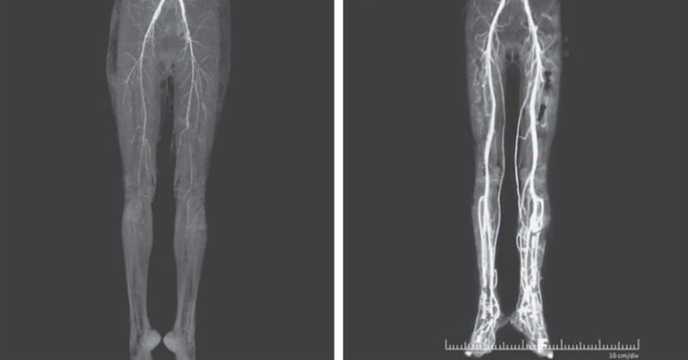 Woman Experiencing Burning Pains Turns Out To Have Medieval ‘Holy Fire’ Disease - Featured image