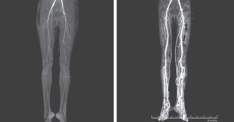 Woman Experiencing Burning Pains Turns Out To Have Medieval ‘Holy Fire’ Disease