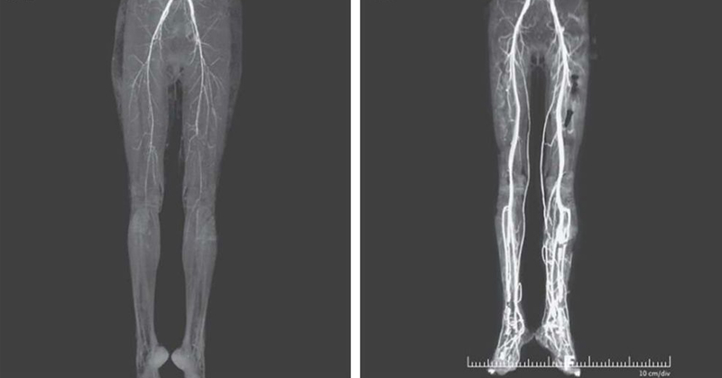 Woman Experiencing Burning Pains Turns Out To Have Medieval ‘Holy Fire’ Disease - Featured image