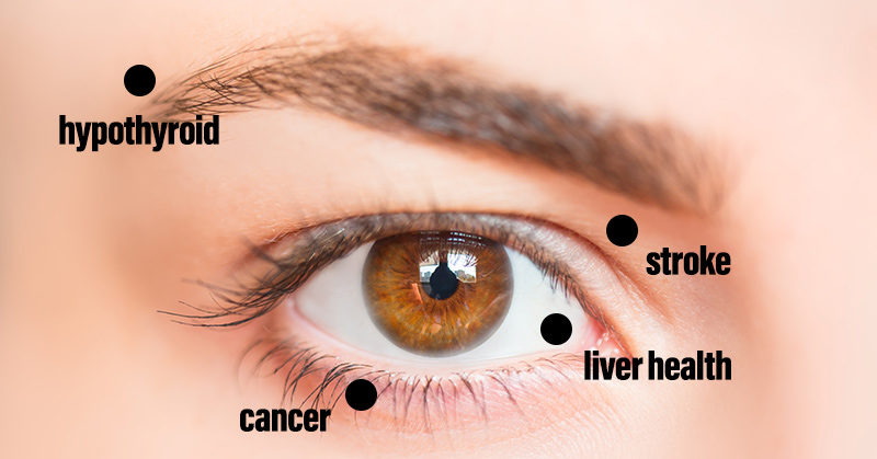 8 Things Your Eyes May be Trying to Tell You About Your Health