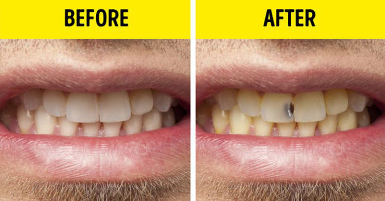 7 Everyday Habits It’s Better Get Rid of As Soon As Possible - Featured image