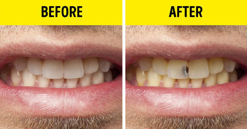 7 Everyday Habits It’s Better Get Rid of As Soon As Possible