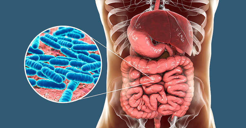 Leaky Gut: What is it? Is it real? And 11 Common Symptoms to Look Out For