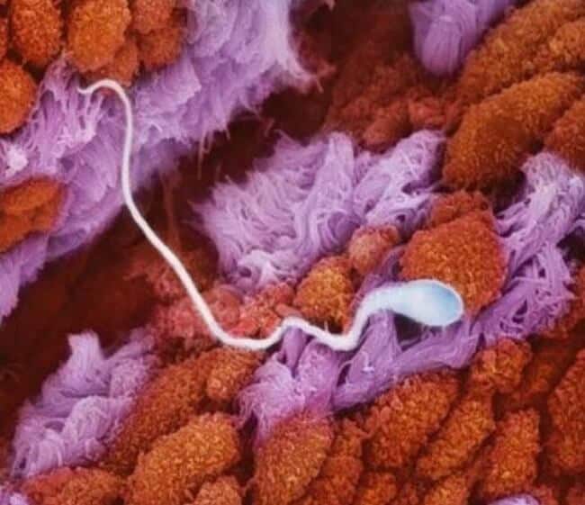 sperm