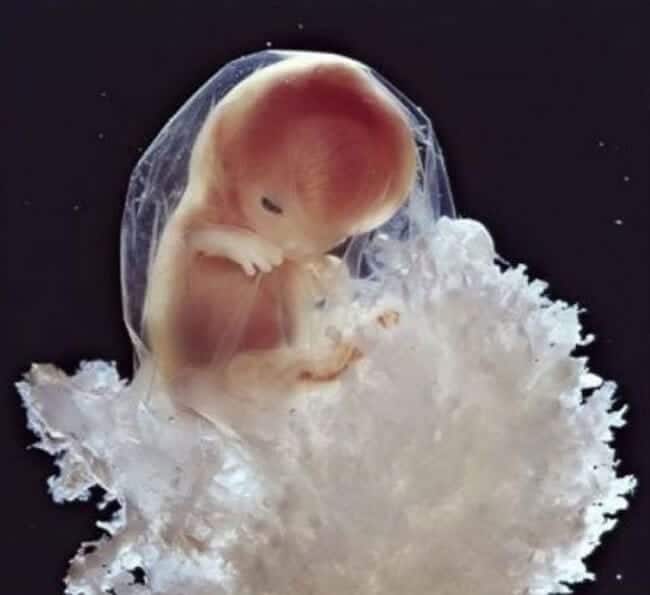 embryo