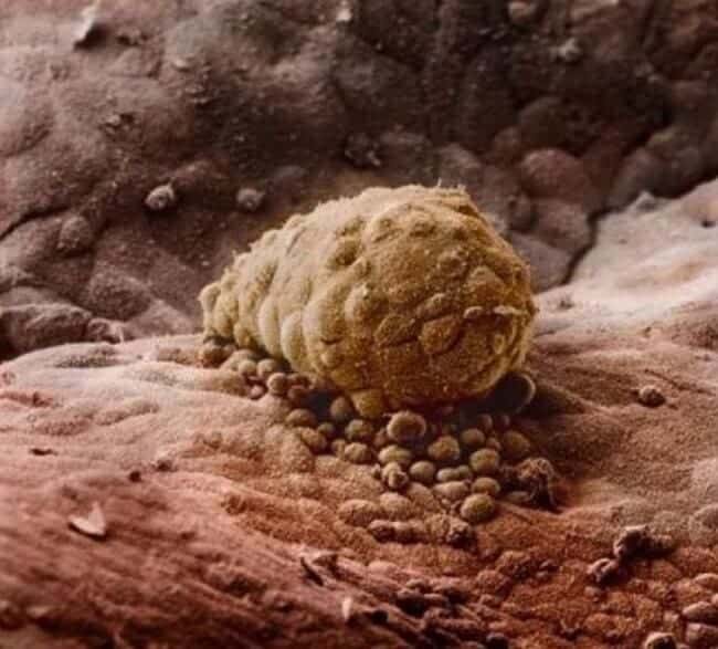 embryo