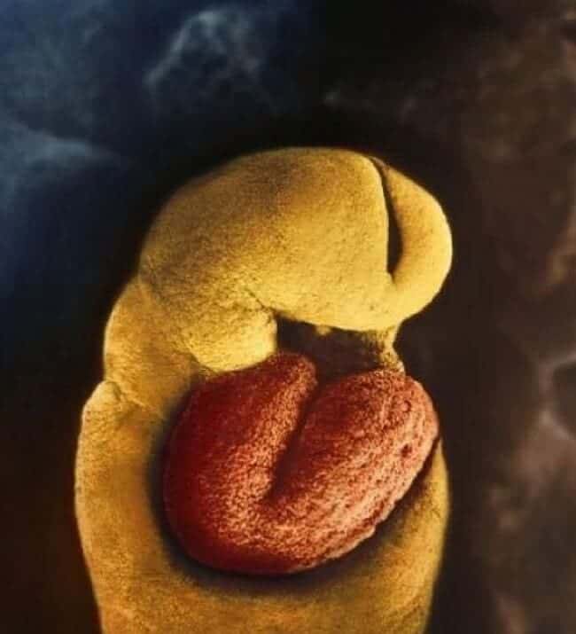 heart