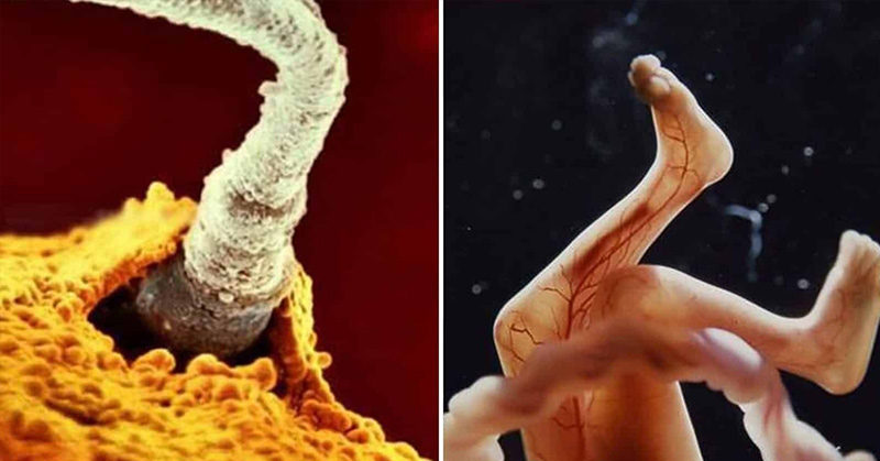 These Photos Perfectly Capture The Stages of Baby Development Before Birth