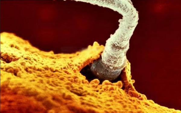 sperm enters egg