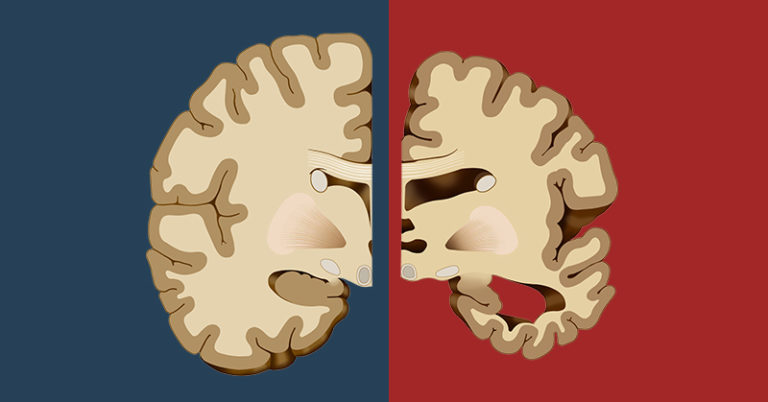 Before Dementia Sets in, Your Body Will Give You These 12 Early Warning Signs - Featured image