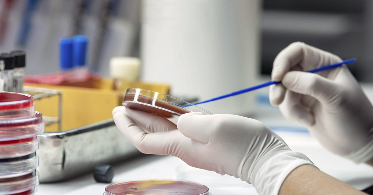 Doctors Still Struggle to Diagnose a Condition That Kills More Americans Than Stroke