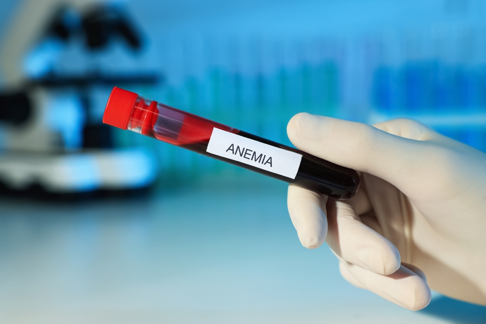 Scientist holding test tube with blood sample and label Anemia on blurred background, closeup