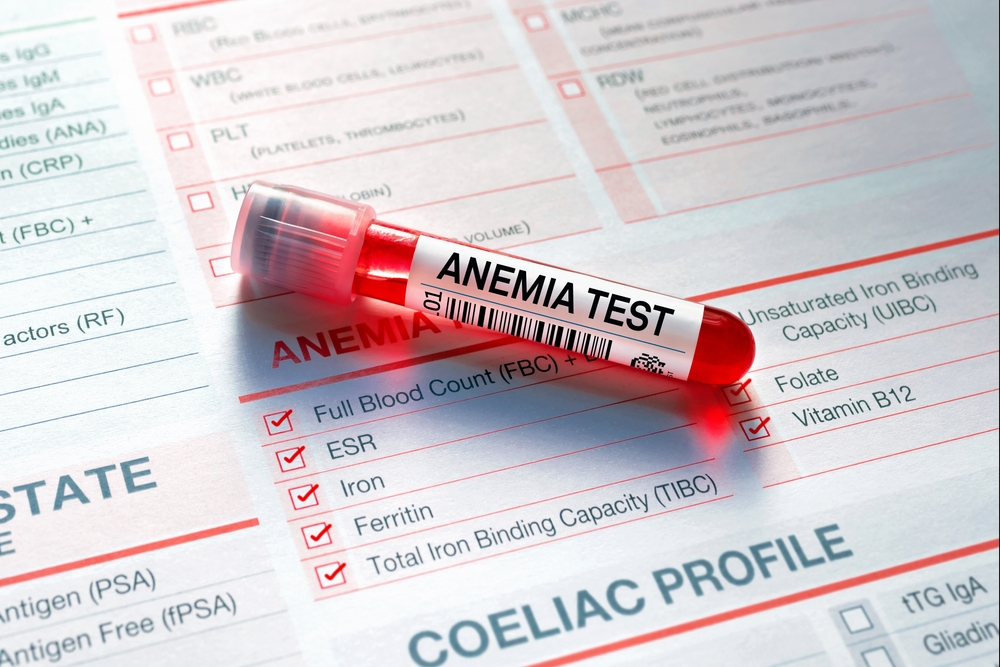 Blood tube test with requisition form for Anaemia test. Blood sample for analysis of Anemia profile test in laboratory