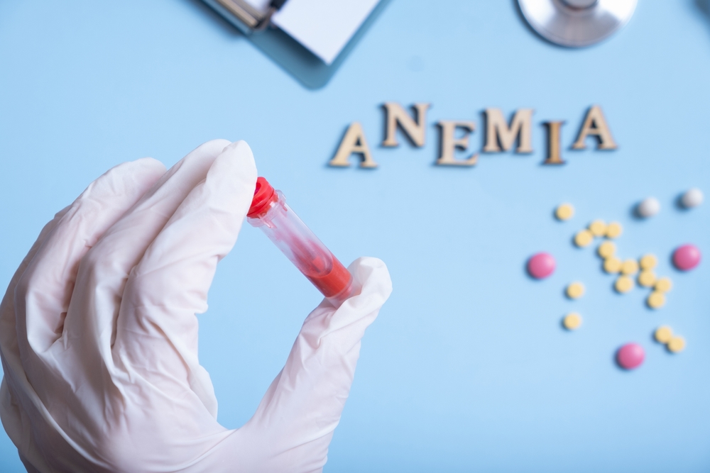 Container with blood analysis in gloved hand and anemia text with cstethoscope, pills.