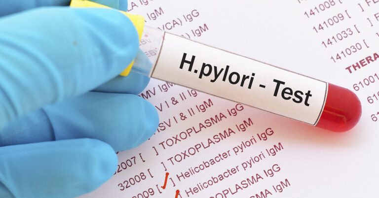 How to treat H. Pylori Bacteria Causing Heartburn And Bloating + Natural Remedies - Featured image