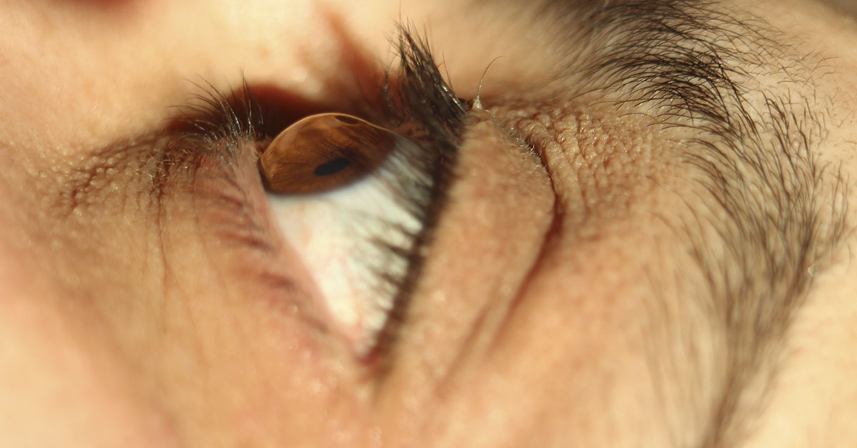 This is Why You Should Never Sleep With Contacts In