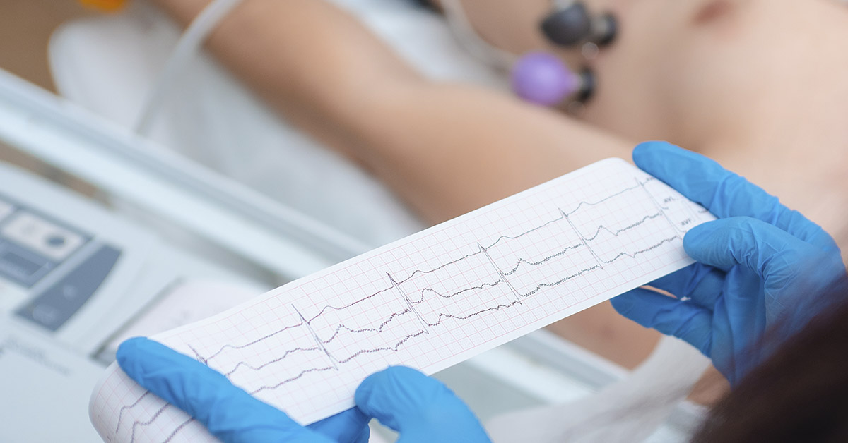 Heart Health: 6 Foods Cardiologists Try to Avoid