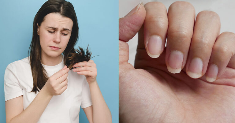 15 Foods To Eat More of For Healthy Hair and Nails - Featured image