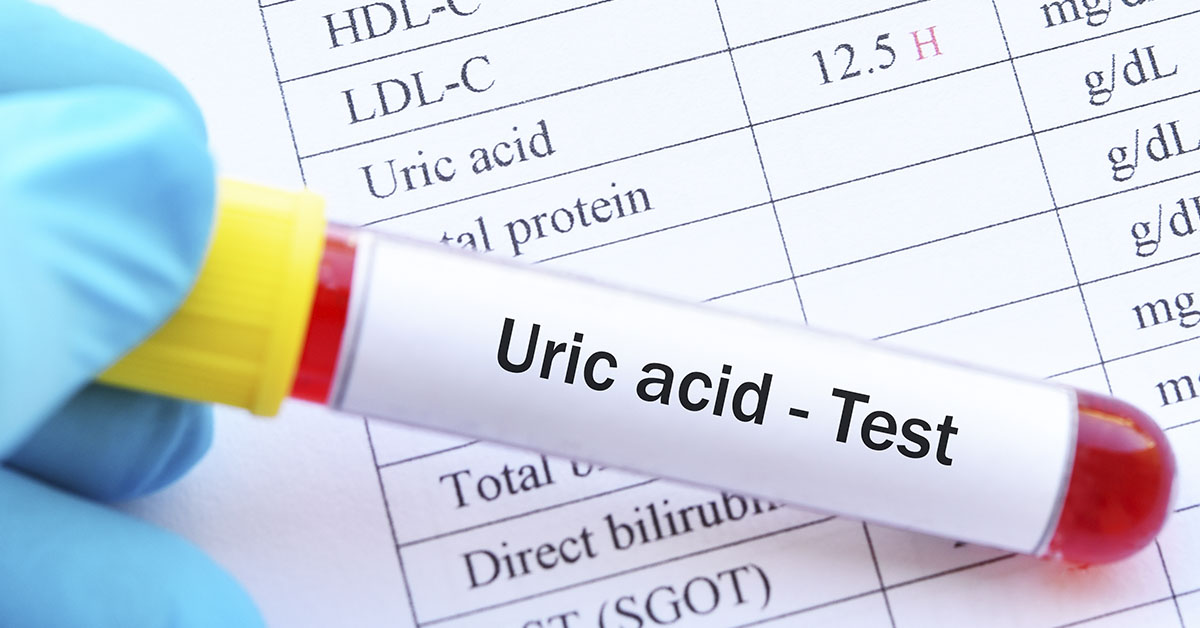 Natural Ways to Reduce Uric Acid in the Body