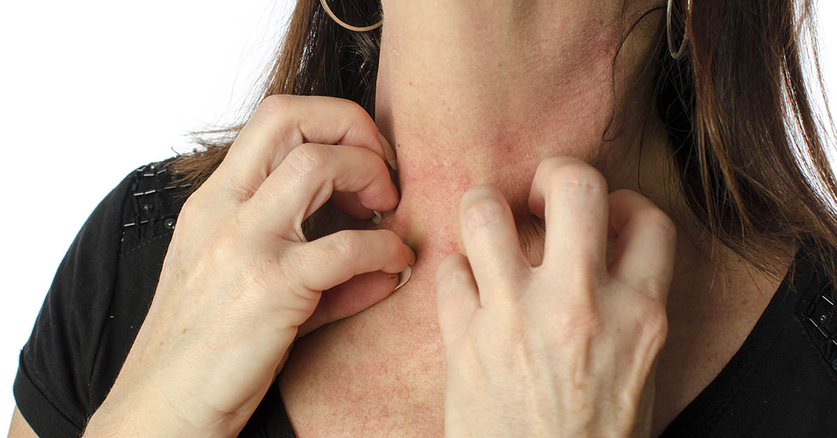 18 Signs of Histamine Intolerance (and what causes it)