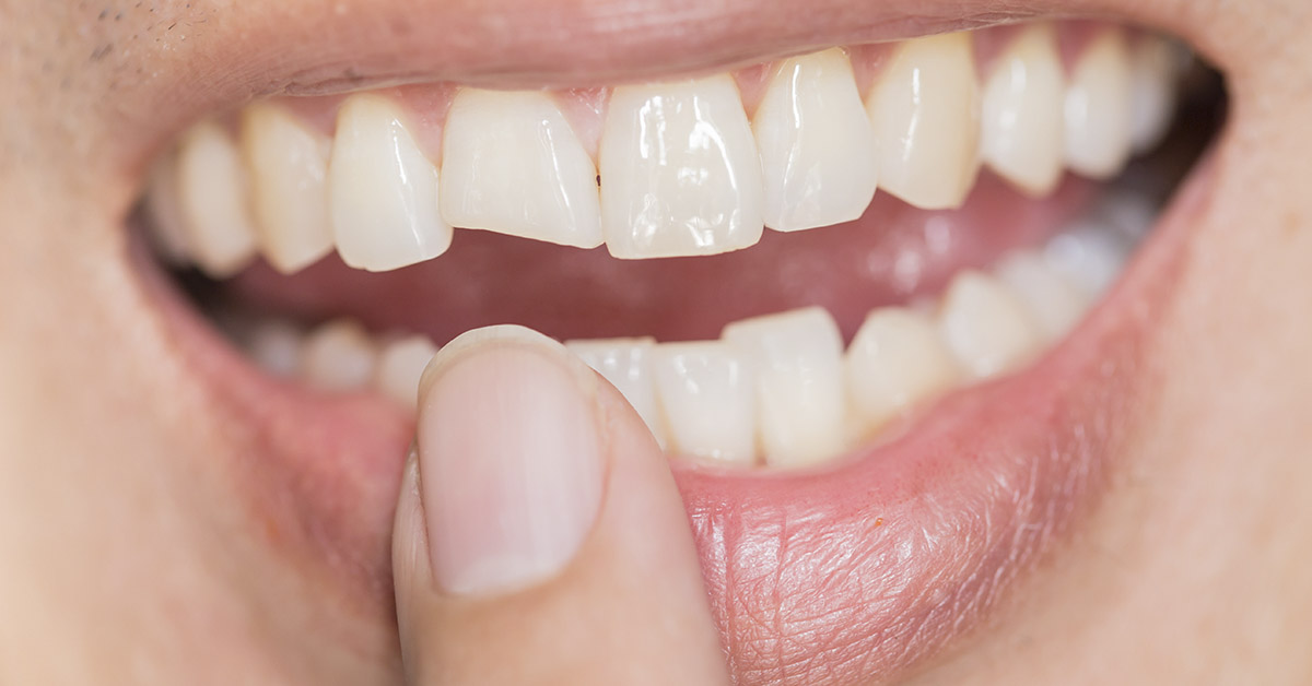 New Treatment Makes Teeth Grow Back
