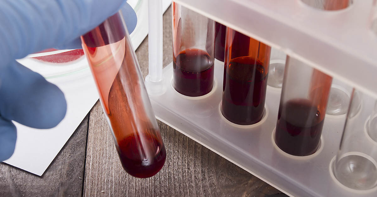 Could Stem Cells from Menstrual Blood Help Treat Diseases Like Alzheimer’s?