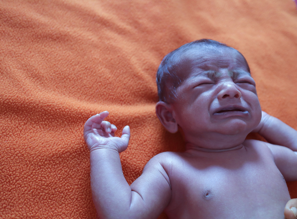 a cyanotic blue baby crying in pain and distress