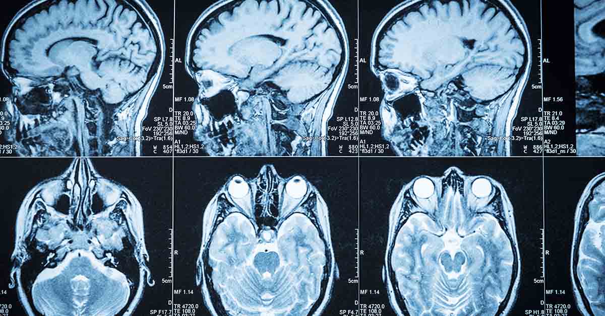 15 Things to Start Doing at 50 To Help Save Your Brain at 80