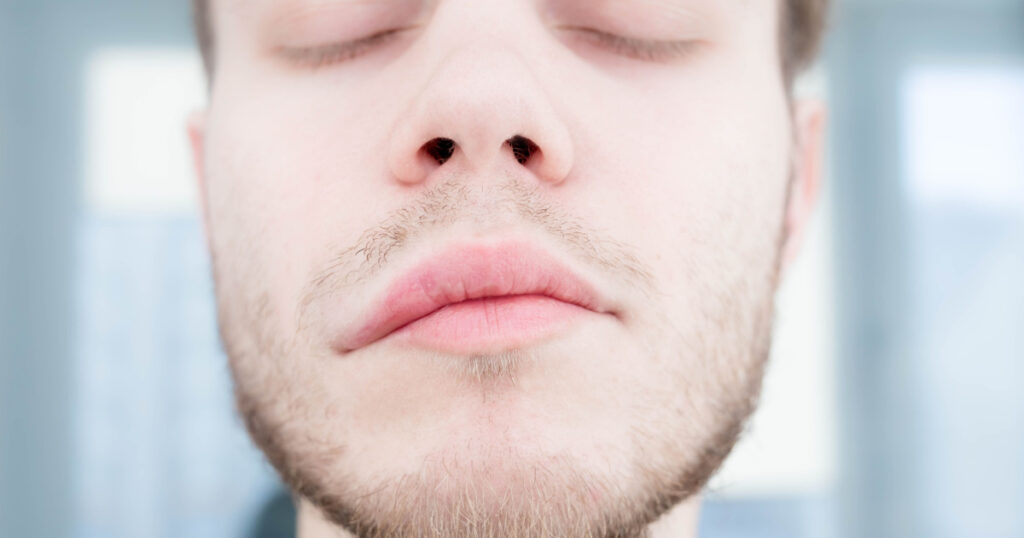 symptom oflyme disease, . Neurological Symptoms