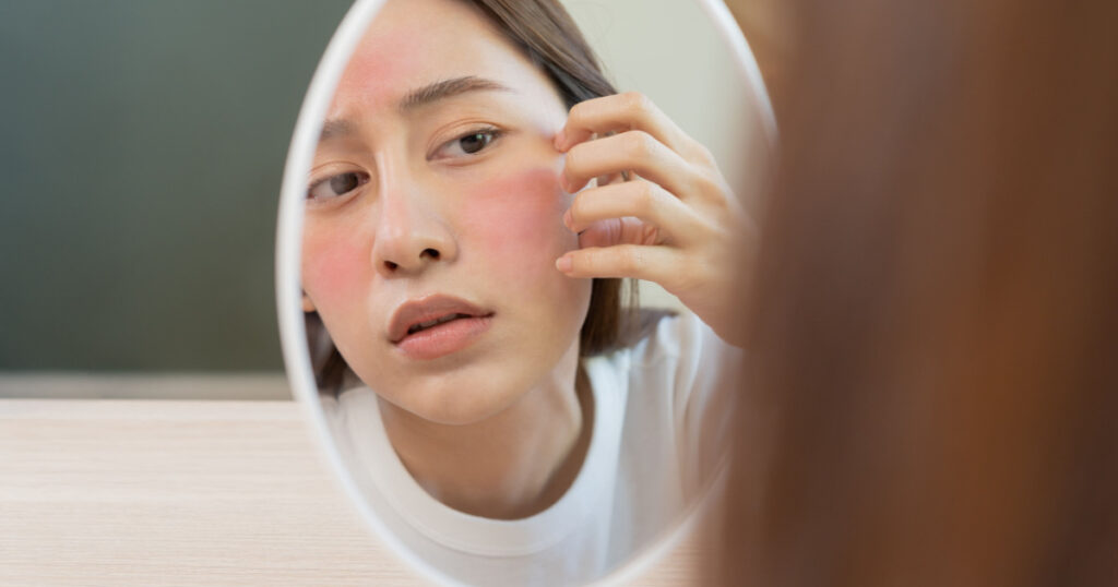 Skin Irritation