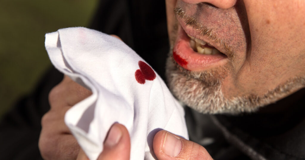 Close up from a man with bloody tissue
