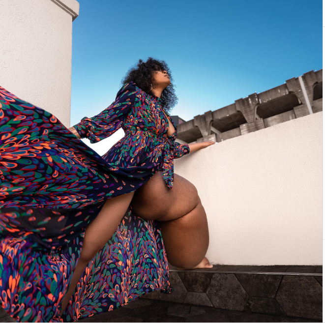 model with lymphedema
