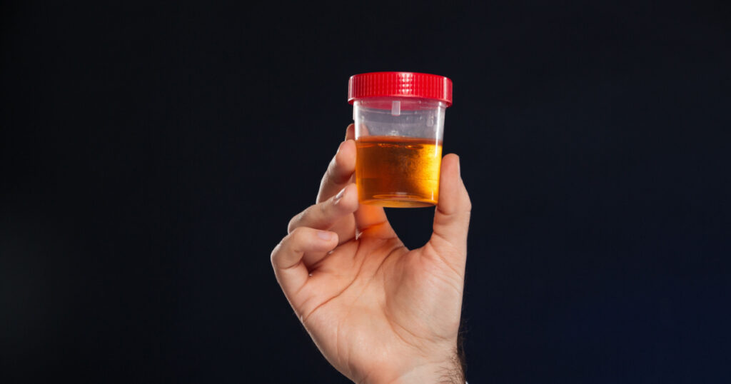 Close up of male's hand holding container with urine sample isolated over dark background