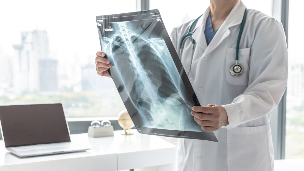 Human hands holding lung organ symbol. Awareness of lung cancer, pneumonia, asthma, COPD, pulmonary hypertension, world no tobacco day and eco air pollution. Respiratory and chest concept.