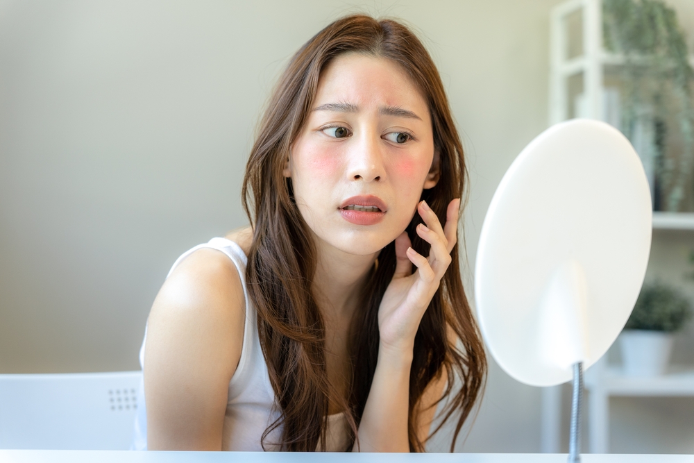 Young woman asian are worried about faces Dermatology and allergic to steroids in cosmetics. sensitive skin,red face from sunburn, acne,allergic to chemicals,rash on face. skin problems and beauty