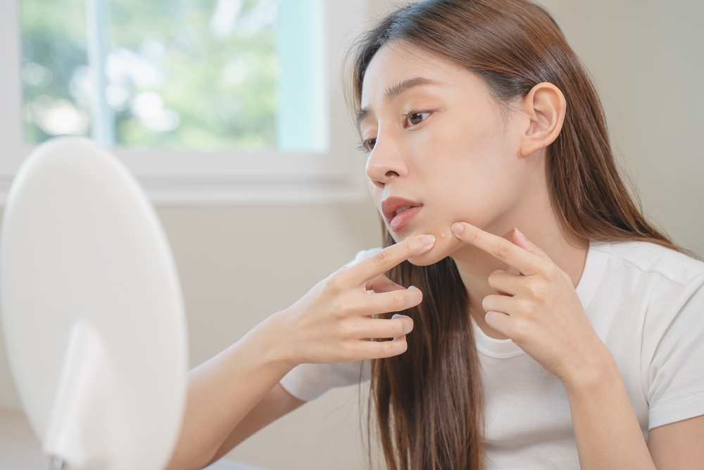 skin problem treatment. Women looking acne on her face in the mirror.
