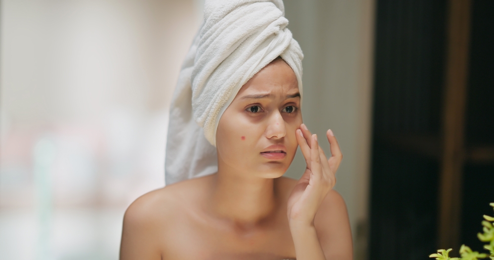 Indian upset young adult woman wrapped towel on head and body reflected look mirror feel stressed about facial skin problem. Shocked teen girl worried for blackhead acne pimple touch face in bathroom
