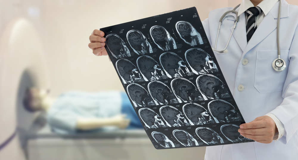 Doctor examine film x-ray the brain by mri scan of the patient.