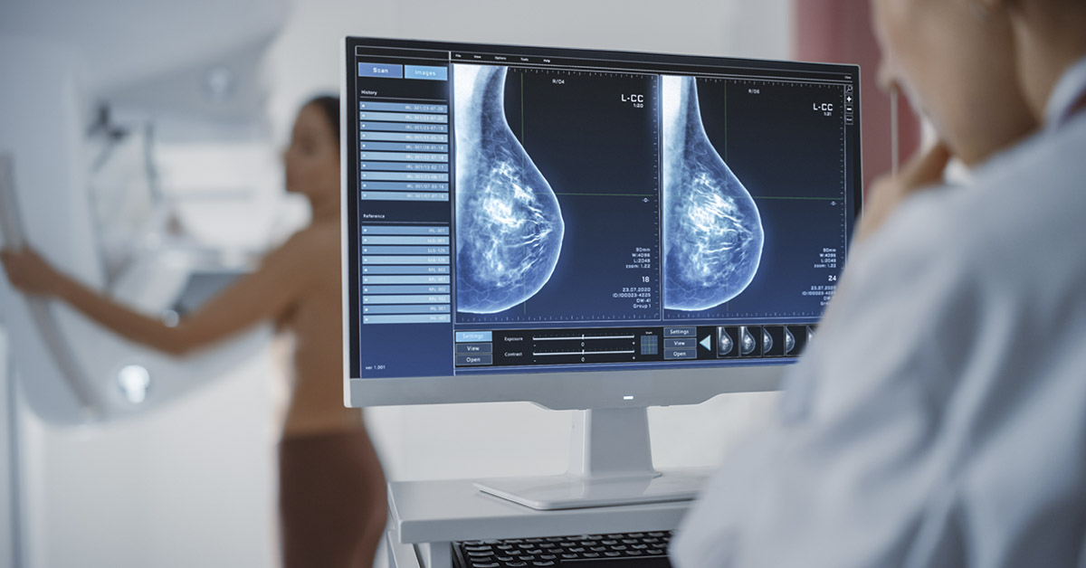 Cancer Deaths Are Declining, but Troubling Rise in Colon and Breast Cancer in Young Adults, Report Says