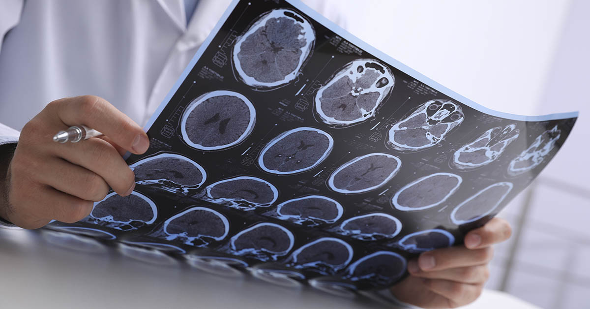 25 Things Only Someone with MS Would Know