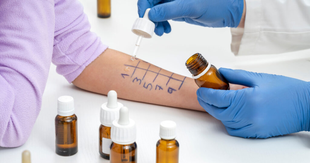 ALLERGY SKIN TEST. HEALTH CARE CONCEPT. HEALTH INSURANCE.