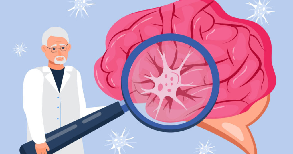 Brain with EKG, encephalogram machine. Neuron under magnifying glass. Neurology problems, Parkinson disease and Alzheimer. Neurologist online consultation concept vector
